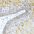 S100A7 / Psoriasin Antibody - Immunohistochemistry of paraffin-embedded human esophagus.
