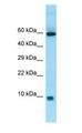 S100A7A / S100A15 Antibody - S100A7A / S100A15 antibody Western Blot of Fetal Heart.  This image was taken for the unconjugated form of this product. Other forms have not been tested.