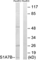 S100A7L2 Antibody - Western blot analysis of lysates from HUVEC cells, using S100A7L2 Antibody. The lane on the right is blocked with the synthesized peptide.