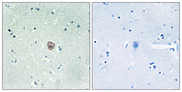 S1PR5 / EDG8 / S1P5 Antibody - Immunohistochemistry analysis of paraffin-embedded human brain tissue, using EDG8 Antibody. The picture on the right is blocked with the synthesized peptide.