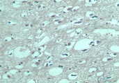 S1PR5 / EDG8 / S1P5 Antibody - IHC (paraffin) staining of normal human brain using control (rabbit Ig) at 5 ug/ml.