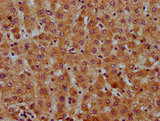 SAA2 / Serum Amyloid A2 Antibody - Immunohistochemistry Dilution at 1:600 and staining in paraffin-embedded human liver tissue performed on a Leica BondTM system. After dewaxing and hydration, antigen retrieval was mediated by high pressure in a citrate buffer (pH 6.0). Section was blocked with 10% normal Goat serum 30min at RT. Then primary antibody (1% BSA) was incubated at 4°C overnight. The primary is detected by a biotinylated Secondary antibody and visualized using an HRP conjugated SP system.