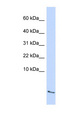 SAA4 Antibody - SAA4 antibody Western blot of Fetal Lung lysate. This image was taken for the unconjugated form of this product. Other forms have not been tested.