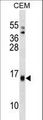 SAA4 Antibody - SAA4 Antibody western blot of CEM cell line lysates (35 ug/lane). The SAA4 antibody detected the SAA4 protein (arrow).