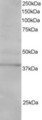 SAE1 Antibody - Antibody staining (1 ug/ml) of Jurkat lysate (RIPA buffer, 30 ug total protein per lane). Primary incubated for 1 hour. Detected by Western blot of chemiluminescence.