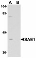 SAE1 Antibody - Western blot of SAE1 in SK-N-SH lysate with SAE1 antibody at 1 ug/ml in (A) the absence and (B) the presence of blocking peptide.