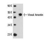 SAG / Arrestin Antibody - Visual Arrestin (PDS-1): Western blot of Visual Arrestin expression in human retina tissue extract.  This image was taken for the unconjugated form of this product. Other forms have not been tested.