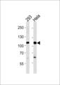SALL4 Antibody - SALL4 Antibody western blot of 293,HeLa cell line lysates (35 ug/lane). The SALL4 antibody detected the SALL4 protein (arrow).