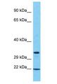 SAMD10 Antibody - SAMD10 antibody Western Blot of 786-0. Antibody dilution: 1 ug/ml.  This image was taken for the unconjugated form of this product. Other forms have not been tested.