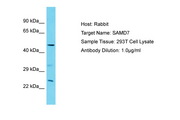 SAMD7 Antibody -  This image was taken for the unconjugated form of this product. Other forms have not been tested.