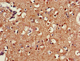 SAMD8 Antibody - Immunohistochemistry of paraffin-embedded human brain tissue using SAMD8 Antibody at dilution of 1:100
