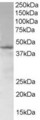 SAMSN1 Antibody - Antibody (1 ug/ml) staining of Jurkat lysate (35 ug protein in RIPA buffer). Primary incubation was 1 hour. Detected by chemiluminescence.