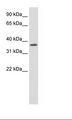 SAP30BP / HTRG Antibody - Fetal Muscle Lysate.  This image was taken for the unconjugated form of this product. Other forms have not been tested.