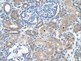 SARDH Antibody - SARDH antibody SARDH(sarcosine dehydrogenase) Antibody was used in IHC to stain formalin-fixed, paraffin-embedded human kidney.  This image was taken for the unconjugated form of this product. Other forms have not been tested.