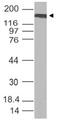 SARS-CoV-2 Spike Glycoprotein Antibody - Western Blot analysis of SARS-CoV-2 Spike Glycoprotein Antibody used at 2 µg/ml on full-length SARS-CoV-2 Spike Glycoprotein (150 ng/lane).