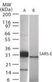 SARS-CoV Envelope Antibody - Western blot of SARS-E in (A) recombinant fusion protein containing amino acids 59-70 and (B) fusion partner without these amino acids, using antibody at 1 ug/ml.