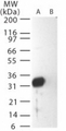 SARS-CoV Matrix Antibody - Western blot of SARS-M in (A) recombinant fusion protein containing amino acids195-210 and (B) fusion partner without these amino acids, using antibody at0.5 ug/ml.