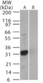 SARS-CoV NSP3b Antibody - Western blot of SARS-3b in (A) recombinant fusion protein containing amino acids 31-45 and (B) fusion partner without these amino acids, using antibody at 0.5 ug/ml.