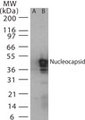 SARS-CoV Nucleoprotein Antibody - Western blot of SARS Nucleocapsid in (A) untransfected mouse melanoma cell lysate and (B) transfected cell lysate using antibody at a 1:2000 dilution.