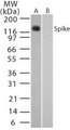 SARS-CoV Spike Glycoprotein Antibody - Western blot of Spike in (A) transfected and (B) untransfected mouse melanoma cell lysate using antibody at 0.05 ug/ml.