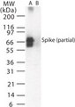 SARS-CoV Spike Glycoprotein Antibody - Western blot of SARS Spike in (A) transfected mouse melanoma cell lysate and (B) untransfected cell lysate using antibody at 0.5 ug/ml.