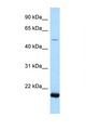 SARS2 / SYS Antibody - SARS2 / Seryl-tRNA Synthetase 2 antibody Western blot of 721_B Cell lysate. Antibody concentration 1 ug/ml.  This image was taken for the unconjugated form of this product. Other forms have not been tested.