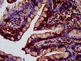 SAT2 Antibody - Immunohistochemistry image at a dilution of 1:400 and staining in paraffin-embedded human small intestine tissue performed on a Leica BondTM system. After dewaxing and hydration, antigen retrieval was mediated by high pressure in a citrate buffer (pH 6.0) . Section was blocked with 10% normal goat serum 30min at RT. Then primary antibody (1% BSA) was incubated at 4 °C overnight. The primary is detected by a biotinylated secondary antibody and visualized using an HRP conjugated SP system.