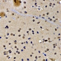SATB1 Antibody - Immunohistochemical analysis of SATB1 staining in rat brain formalin fixed paraffin embedded tissue section. The section was pre-treated using heat mediated antigen retrieval with sodium citrate buffer (pH 6.0). The section was then incubated with the antibody at room temperature and detected using an HRP conjugated compact polymer system. DAB was used as the chromogen. The section was then counterstained with hematoxylin and mounted with DPX.