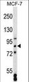 SATB2 Antibody - SATB2 Antibody western blot of MCF-7 cell line lysates (35 ug/lane). The SATB2 antibody detected the SATB2 protein (arrow).