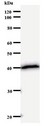 SATB2 Antibody - Western blot of immunized recombinant protein using SATB2 antibody.