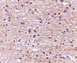 SATB2 Antibody - Immunohistochemistry of SATB2 in human brain with SATB2 antibody at 5 ug/ml.