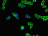 SBNO2 Antibody - Immunofluorescent analysis of HepG2 cells using SBNO2 Antibody at dilution of 1:100 and Alexa Fluor 488-congugated AffiniPure Goat Anti-Rabbit IgG(H+L)