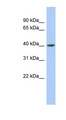SCAD / ACADS Antibody - ACADS antibody Western blot of Fetal Intestine lysate. This image was taken for the unconjugated form of this product. Other forms have not been tested.