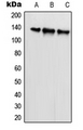 SCAF1 Antibody - Western blot analysis of SCAF1 expression in HeLa (A); U2OS (B); NIH3T3 (C) whole cell lysates.