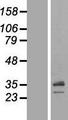 SCAMP1 / SCAMP Protein - Western validation with an anti-DDK antibody * L: Control HEK293 lysate R: Over-expression lysate