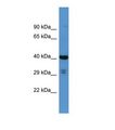 SCAMP3 Antibody - Western blot of Human RPMI-8226. SCAMP3 antibody dilution 1.0 ug/ml.  This image was taken for the unconjugated form of this product. Other forms have not been tested.