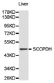 SCCPDH Antibody - Western blot of extracts of liver cell lines, using SCCPDH antibody.