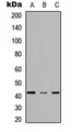 SCD1 / SCD Antibody - Western blot analysis of SCD expression in HeLa (A); NS-1 (B); PC12 (C) whole cell lysates.