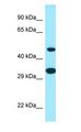 SCD5 / SCD4 Antibody - SCD5 / SCD4 antibody Western Blot of Human heart.  This image was taken for the unconjugated form of this product. Other forms have not been tested.