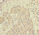 SCFD1 / SLY1 Antibody - Immunohistochemistry of paraffin-embedded human pancreatic tissue at dilution of 1:100