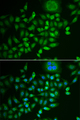 SCG2 / Secretogranin II Antibody - Immunofluorescence analysis of MCF-7 cells.