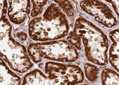 SCG3 / Secretogranin 3 Antibody - 1:100 staining human kidney tissue by IHC-P. The sample was formaldehyde fixed and a heat mediated antigen retrieval step in citrate buffer was performed. The sample was then blocked and incubated with the antibody for 1.5 hours at 22°C. An HRP conjugated goat anti-rabbit antibody was used as the secondary.