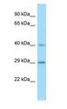 SCG5 / 7B2 Antibody - SCG5 / 7B2 antibody Western Blot of Jurkat.  This image was taken for the unconjugated form of this product. Other forms have not been tested.