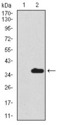 SCGB1A1 / Uteroglobin Antibody - Western blot using SCGB1A1 monoclonal antibody against HEK293 (1) and SCGB1A1 (AA: 26-91)-hIgGFc transfected HEK293 (2) cell lysate.