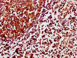 SCIMP Antibody - Immunohistochemistry Dilution at 1:500 and staining in paraffin-embedded human lymph node tissue performed on a Leica BondTM system. After dewaxing and hydration, antigen retrieval was mediated by high pressure in a citrate buffer (pH 6.0). Section was blocked with 10% normal Goat serum 30min at RT. Then primary antibody (1% BSA) was incubated at 4°C overnight. The primary is detected by a biotinylated Secondary antibody and visualized using an HRP conjugated SP system.