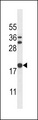 SCLIP / STMN3 Antibody - STMN3 Antibody western blot of K562 cell line lysates (35 ug/lane). The STMN3 antibody detected the STMN3 protein (arrow).
