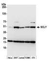 SCLY Antibody - Detection of human and mouse SCLY by western blot. Samples: Whole cell lysate (15 µg) from HeLa, HEK293T, Jurkat, mouse TCMK-1, and mouse NIH 3T3 cells prepared using NETN lysis buffer. Antibody: Affinity purified rabbit anti-SCLY antibody used for WB at 1:1000. Detection: Chemiluminescence with an exposure time of 30 seconds.
