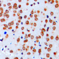 SCN1A / Nav1.1 Antibody - Immunohistochemical analysis of Nav1.1 staining in human brain formalin fixed paraffin embedded tissue section. The section was pre-treated using heat mediated antigen retrieval with sodium citrate buffer (pH 6.0). The section was then incubated with the antibody at room temperature and detected using an HRP conjugated compact polymer system. DAB was used as the chromogen. The section was then counterstained with hematoxylin and mounted with DPX.