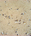 SCN1B Antibody - SCN1B Antibody immunohistochemistry of formalin-fixed and paraffin-embedded human brain tissue followed by peroxidase-conjugated secondary antibody and DAB staining.