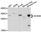 SCN3B Antibody - Western blot analysis of extracts of various cell lines, using SCN3B antibody at 1:1000 dilution. The secondary antibody used was an HRP Goat Anti-Rabbit IgG (H+L) at 1:10000 dilution. Lysates were loaded 25ug per lane and 3% nonfat dry milk in TBST was used for blocking. An ECL Kit was used for detection and the exposure time was 5s.